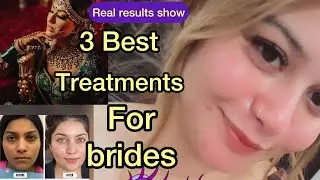 3BestTreatments to Every bride needs must| showing real results|No filter| best prices