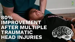 Over 80% Relief After Multiple Concussions and Neck Injuries! (Treatment)