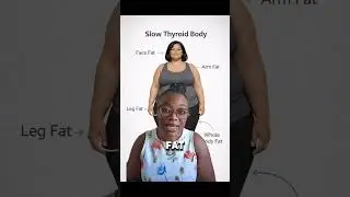 Doctor Says Thyroid Is Normal? Check These Tests #thyroidfunction #shorts1k