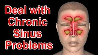 7 WAYS TO TREATMENT FOR CHRONIC SINUS PROBLEMS PERMANENTLY!! HOME REMEDIES!!FOOTLOOSE!!