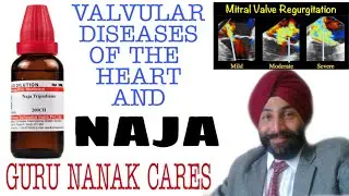 हार्ट के वाल्व्स का बेस्ट इलाज | ROLE OF NAJA IN VALVULAR DISEASES OF THE HEART