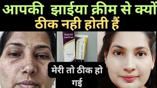 सिर्फ 7 दिनों मे कितनी भी पुरानी झाईया, धाग्- धब्बे 100% खत्म करे। vanshika ka corner