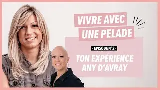 Any d'Avray - Vivre avec une pelade : ton exp&eacute;rience Any d&rsquo;Avray