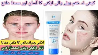 Hp  Acne clear face wash Honest review | Best Oil control face wash - 3 in one solution#facewash