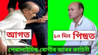 Paralysis Recovery in 10 Days 😱 | Assamese Physiotherapy Success Story | Patient Review