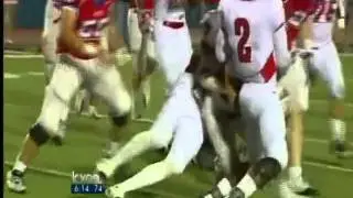 Concussion sensors