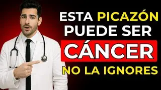 PICAZÓN que ALERTA CÁNCER 5 zonas del cuerpo que NO debes ignorar