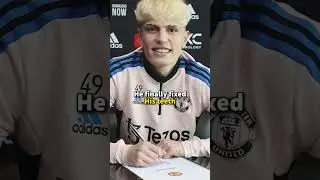 Garnacho FINALLY FIxed his teeth 🤯