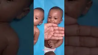 Baby Skin Protection: Root and Soil Solutions for Diaper Rash & Dry Skin!