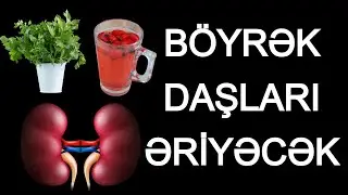 B&ouml;yrək Ağrısının GİZLİ ƏLAMƏTLƏRİ - İnsanların &Ccedil;oxu Bilmir!
