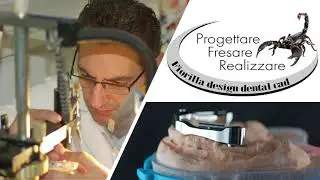 Barre implantari & Toronto implantari di primissima qualit&agrave; realizzate in Lasermelting    VIDEO 2&deg;
