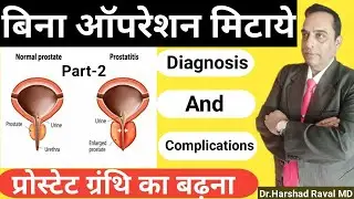 Diagnosis, complications for prostate enlargement| Best homeopathic treatment