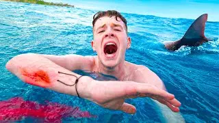 A Shark Attacked Me!