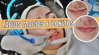 PROTOCOLO LABIAL COM TULÍPIA |Revitalização Sweet Lips + DICAS DE VENDA