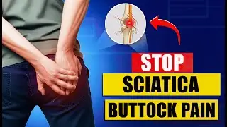 Buttock Pain & Sciatica Causes Explained | Best Piriformis Exercises | Fast Pain Relief Tips