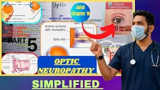 Optic Neuropathy | Optic Nerve | Jatoi Clinical Ophthalmology | Chapter 16 Part 5