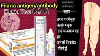 Microfilaria antibody, antigen ll  केसे करे l अच्छी तरह से टेस्ट केसे करे l #filariasis @gkplab