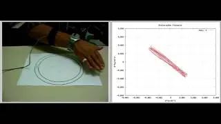 Detection of upper limb motor dysfunction in Parkinson’s disease