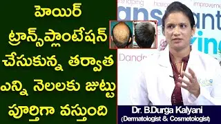 How Many Months Will It Take To Grow Back Complete After Hair Transplantation | Dr B. Durga Kalyani