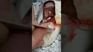 Mystery Egg🥚 What's Inside This Unidentified Clutch🐍