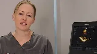 Your Heart Scan founder Claire on why heart maintenance checks are important