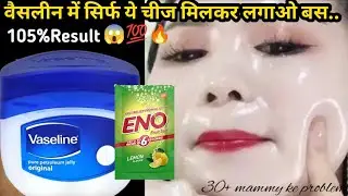 Vaseline & Eno को इस तरीके से चेहरे पर लगालों चेहरा इत्ता गोरा हो जाएगा की सब हैरान हो जाएंगे 