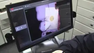 3M True Def Scan at Dr. Marcano's
