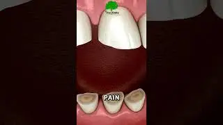 Don&rsquo;t Wait for Pain to See a Dentist! 🎯