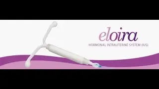 Eloira Loading & Insertion Mechanism - Hormonal IUD