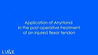 Application of AnyHand - Flexor Tendon Rupture