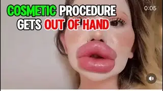 Where Is The Limit Here? #funny #foolishness #wtfe #wtf #cosmetics #lipfiller #dailyfun