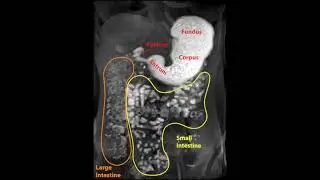 Non-invasive assessment of gastric emptying, gastric motility, pyloric opening, and bowel movements