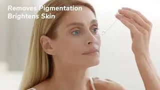 ✨ Best Pigmentation Serum | Kojic Acid + Niacinamide + Resorcinol + Gotukola | Dark Spots