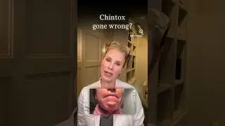 Chin Botox gone wrong? #botox #filler #beauty