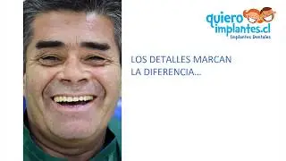 ENTREVISTA CASO CLINICO, IMPLANTES DENTALES
