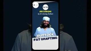 Buttock Fat Grafting (BBL) | Case 16/50 | Dr Umang Kothari  #haircare #liposuction #mensgrooming