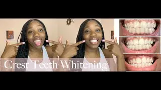 TESTING CREST 3D WHITESTRIPS! | honest review! | 2 week results!