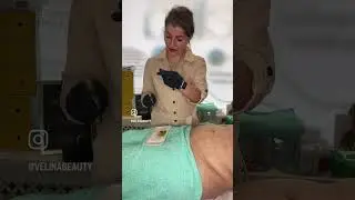 LEMON BOTTLE FAT DISSOLVING🍋💉✨