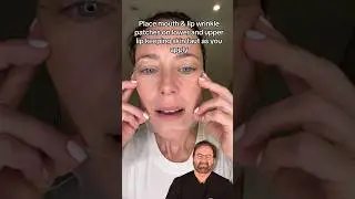 DIY Facelift Surgeon Reacts