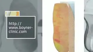insoles for osteoarthritis,insoles for high arch,insoles for