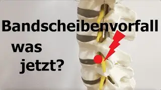 Bandscheibenvorfall