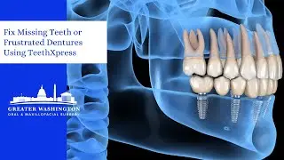 Fix Missing Teeth or Frustrated Dentures Using TeethXpress