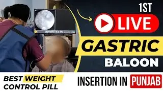 Allurion Gastric Balloon Live Insertion Video | Swallow Pill Weight Loss Balloon | Patient Review