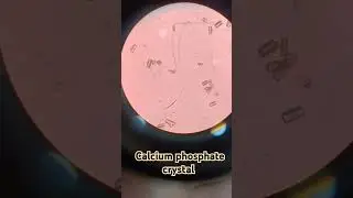 Calcium phosphate crystal in urine..#clinical pathology.#
