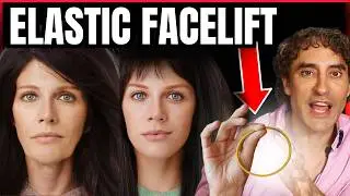 Rubber Band Facelift !!
