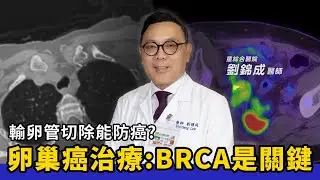 CA125指數高就是卵巢癌？醫師破解健檢迷思！搞懂「這檢查」才是保命關鍵！∣ft.劉錦成醫師∣童綜合醫院 婦產科