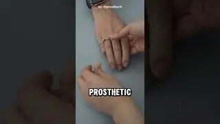 This $1000 Prosthetic Finger is Almost Identical to the Real Thing #shorts