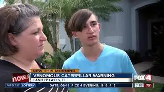 Venomous caterpillar sends Florida boy to ER