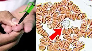 I Put My Blood Under A Microscope!