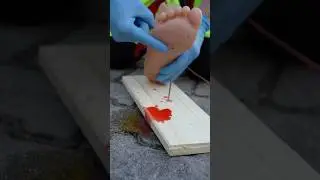 First Aid if you stepped on a Nail! 🚑🩸 #paramedic #ambulance #emergency #firstaid #hospital #nurse